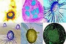 Çorlu’da Ketem Açıldı