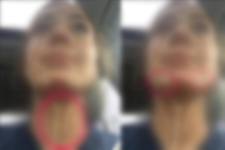 Bronzlaşayım Derken Bu Hale Geldi