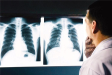 ERÜ Tıp Fakültesinde Kanser Şoku